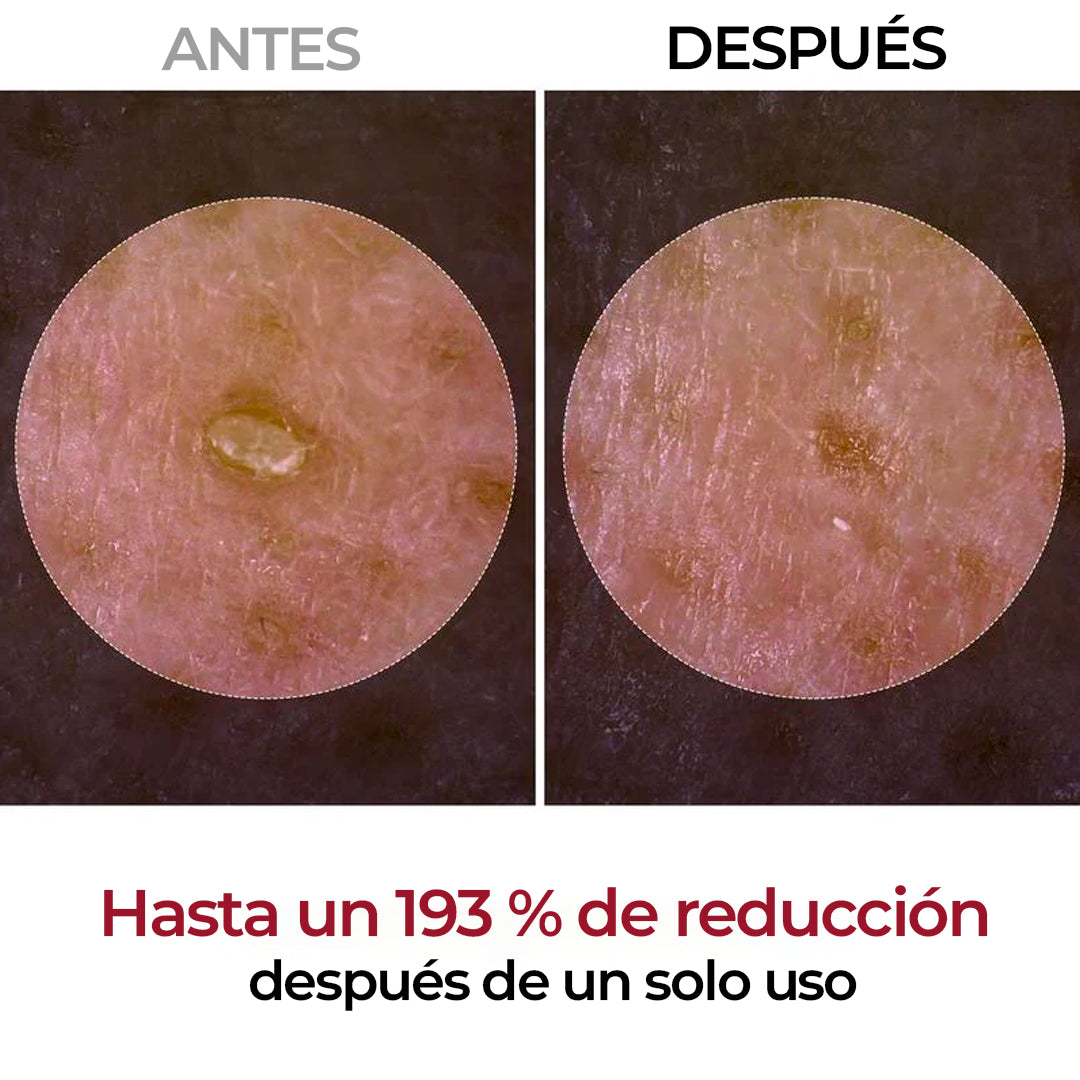 Pack Duo Glow Belira – Recupera tu piel